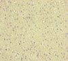 Immunohistochemistry of paraffin-embedded human adrenal gland tissue using CSB-PA617948ESR1HU at dilution of 1:100