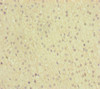 Immunohistochemistry of paraffin-embedded human adrenal gland tissue using CSB-PA617948ESR2HU at dilution of 1:100
