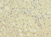 Immunohistochemistry of paraffin-embedded human liver tissue using CSB-PA009283ESR1HU at dilution of 1:100