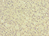 Immunohistochemistry of paraffin-embedded human adrenal gland tissue using CSB-PA819443ESR1HU at dilution of 1:100