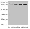 Western blot<br />
 All lanes: ITGB8 antibody at 1.52µg/ml<br />
 Lane 1: 293T whole cell lysate<br />
 Lane 2: Hela whole cell lysate<br />
 Lane 3: HepG2 whole cell lysate<br />
 Lane 4: A549 whole cell lysate<br />
 Secondary<br />
 Goat polyclonal to rabbit IgG at 1/10000 dilution<br />
 Predicted band size: 86, 72 kDa<br />
 Observed band size: 86 kDa<br />