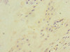 Immunohistochemistry of paraffin-embedded human placenta tissue using CSB-PA011892ESR1HU at dilution of 1:100
