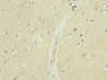 Immunohistochemistry of paraffin-embedded human brain tissue using CSB-PA822201ESR1HU at dilution of 1:100