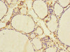 Immunohistochemistry of paraffin-embedded human thyroid tissue using CSB-PA015764ESR2HU at dilution of 1:100
