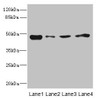 Western blot<br />
 All lanes: PDK3 antibody at 1.6µg/ml<br />
 Lane 1: Mouse kidney tissue<br />
 Lane 2: RAW264.7 whole cell lysate<br />
 Lane 3: A431 whole cell lysate<br />
 Lane 4: HepG2 whole cell lysate<br />
 Secondary<br />
 Goat polyclonal to rabbit IgG at 1/10000 dilution<br />
 Predicted band size: 47, 49 kDa<br />
 Observed band size: 47 kDa<br />