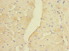 Immunohistochemistry of paraffin-embedded human heart tissue using CSB-PA613585ESR2HU at dilution of 1:100
