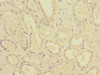 Immunohistochemistry of paraffin-embedded human kidney tissue using CSB-PA019041ESR1HU at dilution of 1:100
