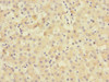 Immunohistochemistry of paraffin-embedded human liver tissue using CSB-PA674736ESR2HU at dilution of 1:100