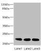 Western blot<br />
 All lanes: CRIP2 antibody at 4.68µg/ml<br />
 Lane 1: Rat heart tissue<br />
 Lane 2: Mouse lung tissue<br />
 Lane 3: MCF-7 whole cell lysate<br />
 Secondary<br />
 Goat polyclonal to rabbit IgG at 1/10000 dilution<br />
 Predicted band size: 23, 31 kDa<br />
 Observed band size: 23 kDa<br />