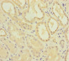 Immunohistochemistry of paraffin-embedded human kidney tissue using CSB-PA896896ESR1HU at dilution of 1:100