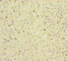Immunohistochemistry of paraffin-embedded human adrenal gland tissue using CSB-PA896896ESR2HU at dilution of 1:100