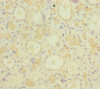 Immunohistochemistry of paraffin-embedded human kidney tissue using CSB-PA014706ESR2HU at dilution of 1:100