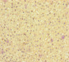 Immunohistochemistry of paraffin-embedded human adrenal gland tissue using CSB-PA014706ESR2HU at dilution of 1:100