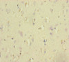 Immunohistochemistry of paraffin-embedded human brain tissue using CSB-PA859576ESR2HU at dilution of 1:100