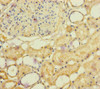 Immunohistochemistry of paraffin-embedded human kidney tissue using CSB-PA859576ESR2HU at dilution of 1:100