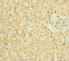 Immunohistochemistry of paraffin-embedded human liver tissue using CSB-PA846105ESR1HU at dilution of 1:100