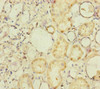 Immunohistochemistry of paraffin-embedded human kidney tissue using CSB-PA846105ESR1HU at dilution of 1:100