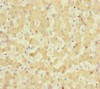 Immunohistochemistry of paraffin-embedded human liver tissue using CSB-PA846105ESR2HU at dilution of 1:100
