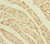 Immunohistochemistry of paraffin-embedded human heart tissue using CSB-PA018476ESR1HU at dilution of 1:100