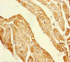 Immunohistochemistry of paraffin-embedded human heart tissue using CSB-PA018476ESR2HU at dilution of 1:100