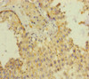 Immunohistochemistry of paraffin-embedded human testis tissue using CSB-PA860359ESR1HU at dilution of 1:100