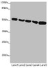 Western blot<br />
 All lanes: SUCLA2 antibody at 1.75µg/ml<br />
 Lane 1: Hela whole cell lysate<br />
 Lane 2: Jurkat whole cell lysate<br />
 Lane 3: A549 whole cell lysate<br />
 Lane 4: 293T whole cell lysate<br />
 Lane 5: HepG2 whole cell lysate<br />
 Secondary<br />
 Goat polyclonal to rabbit IgG at 1/10000 dilution<br />
 Predicted band size: 51, 49 kDa<br />
 Observed band size: 51 kDa<br />