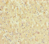 Immunohistochemistry of paraffin-embedded human liver tissue using CSB-PA021690ESR1HU at dilution of 1:100