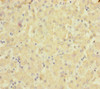 Immunohistochemistry of paraffin-embedded human liver tissue using CSB-PA021690ESR2HU at dilution of 1:100