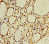 Immunohistochemistry of paraffin-embedded human thyroid tissue using CSB-PA842761ESR1HU at dilution of 1:100
