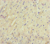 Immunohistochemistry of paraffin-embedded human heart tissue using CSB-PA842761ESR1HU at dilution of 1:100