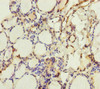 Immunohistochemistry of paraffin-embedded human thyroid tissue using CSB-PA842761ESR2HU at dilution of 1:100