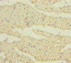 Immunohistochemistry of paraffin-embedded human heart tissue using CSB-PA842761ESR2HU at dilution of 1:100