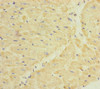 Immunohistochemistry of paraffin-embedded human heart tissue using CSB-PA007156ESR1HU at dilution of 1:100
