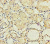 Immunohistochemistry of paraffin-embedded human kidney tissue using CSB-PA896481ESR2HU at dilution of 1:100