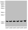 Western blot<br />
 All lanes: MAGOH antibody at 4.69µg/ml<br />
 Lane 1: Mouse kidney tissue<br />
 Lane 2: A431 whole cell lysate<br />
 Lane 3: Jurkat whole cell lysate<br />
 Lane 4: Raji whole cell lysate<br />
 Lane 5: K562 whole cell lysate<br />
 Lane 6: Hela whole cell lysate<br />
 Secondary<br />
 Goat polyclonal to rabbit IgG at 1/10000 dilution<br />
 Predicted band size: 18, 13 kDa<br />
 Observed band size: 18 kDa<br />