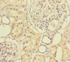 Immunohistochemistry of paraffin-embedded human kidney tissue using CSB-PA015156ESR2HU at dilution of 1:100