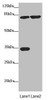 Western blot<br />
 All lanes: MTO1 antibody at 4.11µg/ml<br />
 Lane 1: Rat heart tissue<br />
 Lane 2: Jurkat whole cell lysate<br />
 Secondary<br />
 Goat polyclonal to rabbit IgG at 1/10000 dilution<br />
 Predicted band size: 80, 67, 35, 78, 73, 82 kDa<br />
 Observed band size: 80, 35 kDa<br />