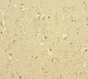 Immunohistochemistry of paraffin-embedded human brain tissue using CSB-PA846064ESR2HU at dilution of 1:100