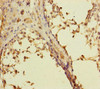 Immunohistochemistry of paraffin-embedded human testis tissue using CSB-PA019178ESR1HU at dilution of 1:100