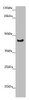 Western blot<br />
 All lanes: RBM17 antibody at 2.35µg/ml + U251 whole cell lysate<br />
 Secondary<br />
 Goat polyclonal to rabbit IgG at 1/10000 dilution<br />
 Predicted band size: 45 kDa<br />
 Observed band size: 45 kDa<br />