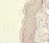 Immunohistochemistry of paraffin-embedded human skin tissue using CSB-PA723351ESR1HU at dilution of 1:100