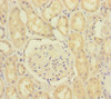 Immunohistochemistry of paraffin-embedded human kidney tissue using CSB-PA840987ESR1HU at dilution of 1:100