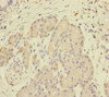 Immunohistochemistry of paraffin-embedded human pancreatic tissue using CSB-PA840987ESR1HU at dilution of 1:100
