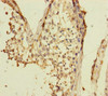 Immunohistochemistry of paraffin-embedded human testis tissue using CSB-PA884447ESR2HU at dilution of 1:100