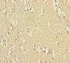 Immunohistochemistry of paraffin-embedded human brain tissue using CSB-PA884447ESR2HU at dilution of 1:100