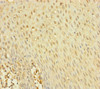 Immunohistochemistry of paraffin-embedded human tonsil tissue using CSB-PA853509ESR2HU at dilution of 1:100