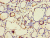 Immunohistochemistry of paraffin-embedded human thyroid tissue using CSB-PA004458YA01HU at dilution of 1:100