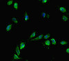 Immunofluorescent analysis of Hela cells using CSB-PA005205LA01HU at dilution of 1:100 and Alexa Fluor 488-congugated AffiniPure Goat Anti-Rabbit IgG (H+L)