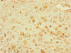 Immunohistochemistry of paraffin-embedded human placenta tissue using CSB-PA005241LA01HU at dilution of 1:100 Immunohistochemistry of paraffin-embedded human placenta tissue using CSB-PA005241LA01HU at dilution of 1:100