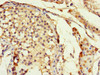 Immunohistochemistry of paraffin-embedded human testis tissue using CSB-PA006956LA01HU at dilution of 1:100 Immunohistochemistry of paraffin-embedded human testis tissue using CSB-PA006956LA01HU at dilution of 1:100